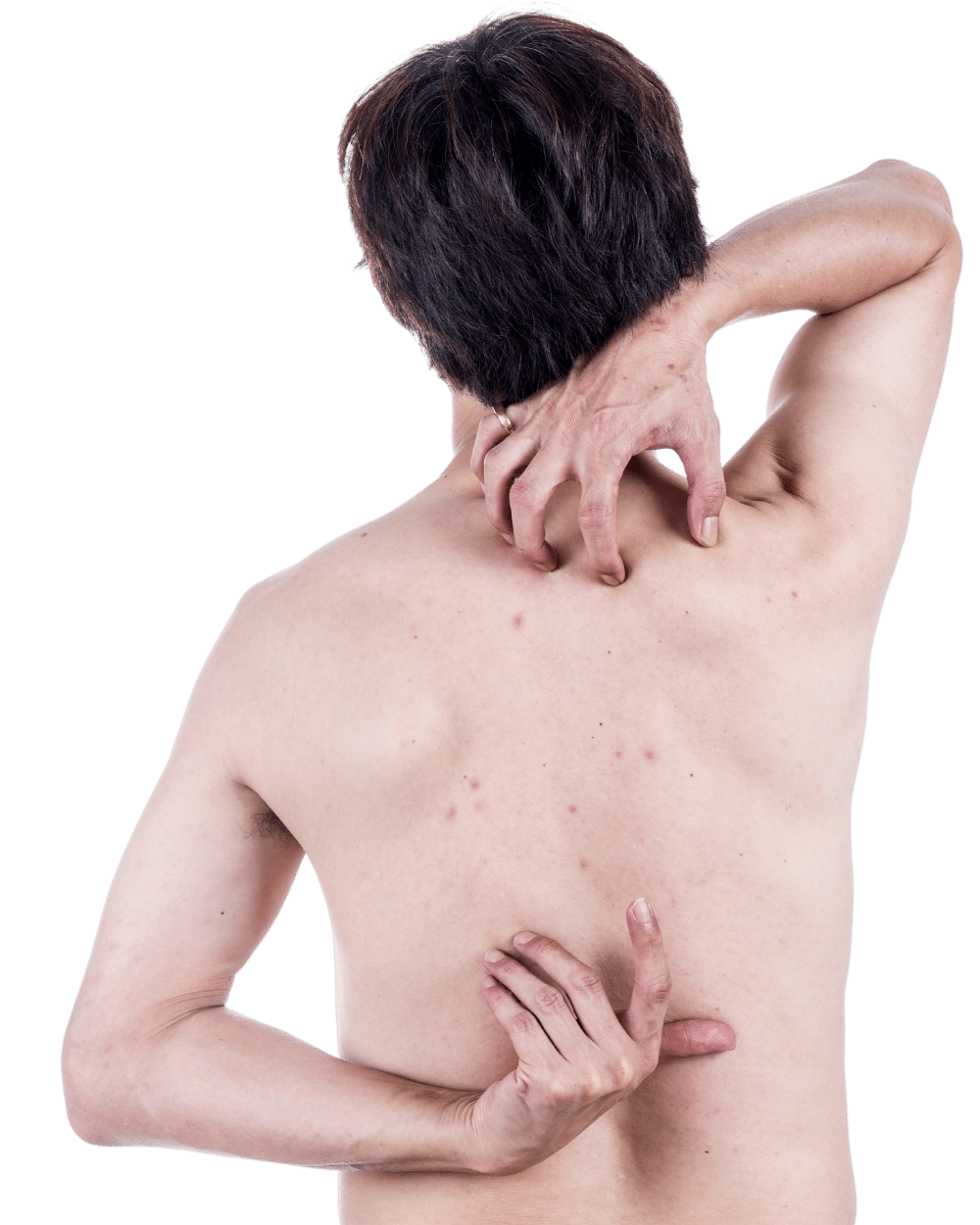 mens health month - men rashes