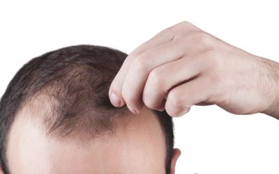 Experiencing Hair Loss? Your Dermatologist Will Help You Find the Root Cause